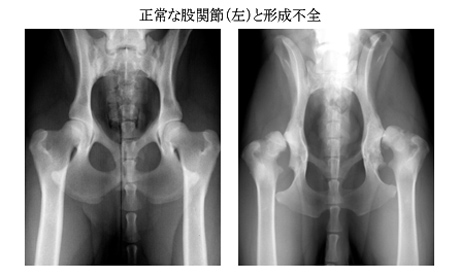 正常な股関節と形成不全